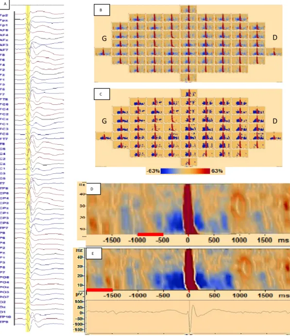 Figure  9  |  Analyse  Temps-Fréquence.  A  :  moyennage  EEG  sur  56  pointes,  B  :  représentation  ATF  pour  chaque  électrode,  C  :  analyse  statistique  (bootstrap  pour  p&lt;0.05),  D  :  Représentation  d’un  seul  canal  d’ATF  pour  la  prem