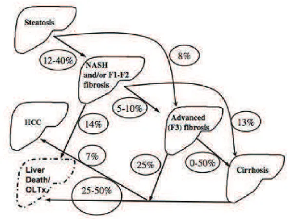 Figure 2. Sch€ma illustrant les rapports de cause  ‚ effet entre la st€atose  h€patique et la NASH, la cirrhose, et la survenue d•un CHC (30).