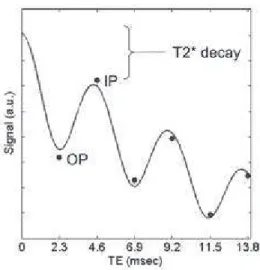 Figure  7.  Illustration de  la  d€croissance  du  signal  due  ‚  la  relaxation T2* 