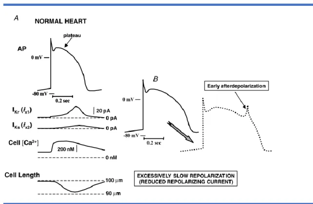 Figure 4. Représentation schématique du potentiel d’action cardiaque et des consé- consé-quences ioniques (et post-dépolarisations) d’un allongement de la repolarisation