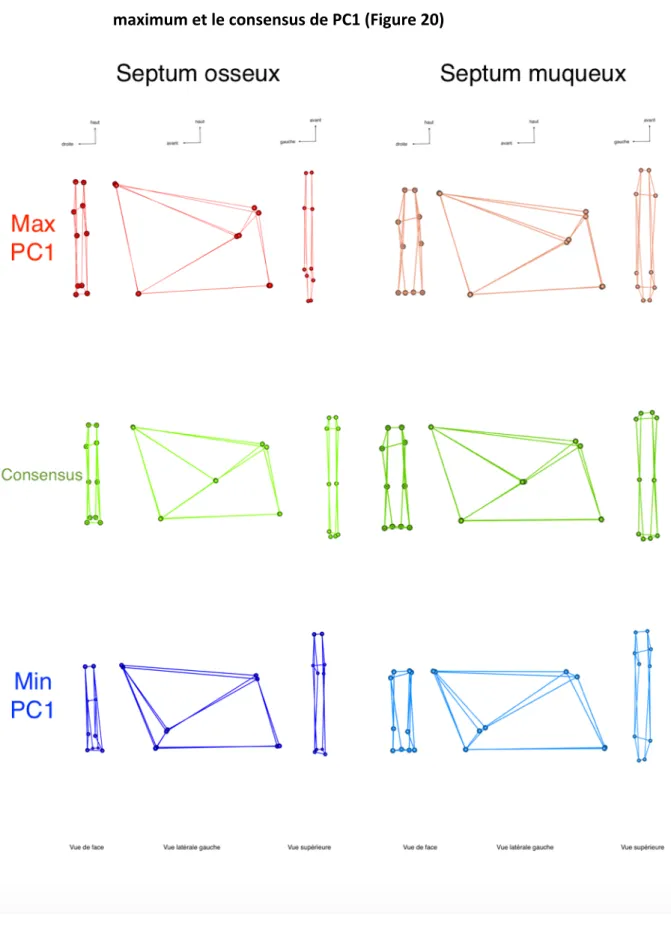 Figure 20.  Comparaison individu consensus (en vert) et variation minimum (en bleu) et  maximum (en rouge) sur la PC 1 pour les septums muqueux et osseux 