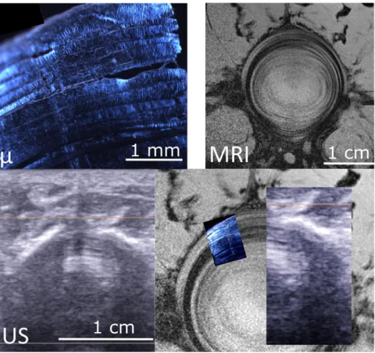 Fig. 5    Second example of  multimodal imaging of annulus  structure. Polarized light  microscopy (μ), magnetic  resonance image (MRI) and  ultrasonography (US) of a cow  tail disc