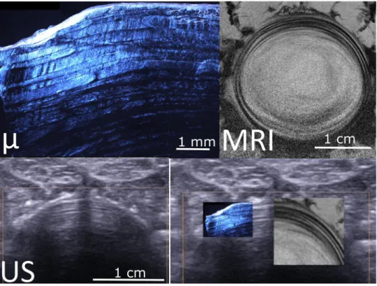 Fig. 4    Example of multimodal  imaging of annulus structure. 