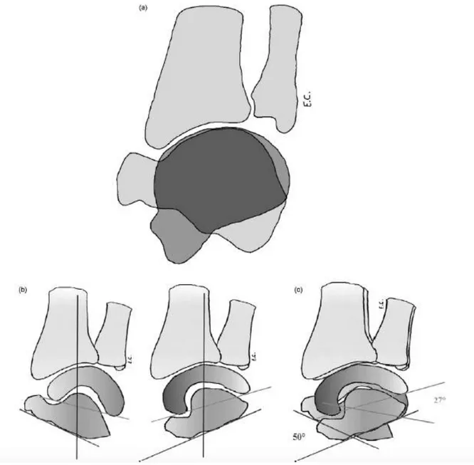 Figure 2: Carpe à double cupule selon Camus et al.. 21  (a) : massif carpien en inclinaison radio-ulnaire 