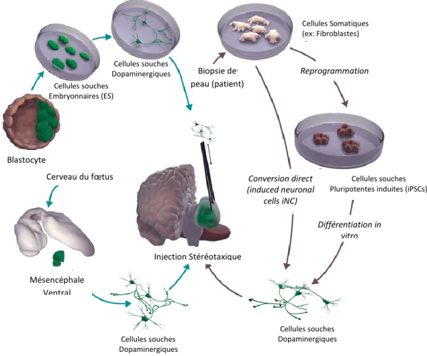 Figure 12 Schéma représentant les différentes étapes de la thérapie cellulaire chez les  parkinsoniens 