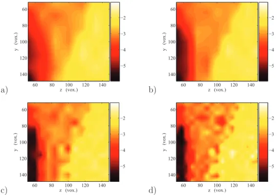 Fig. 7. Comparison between the U z -component of the displacement ﬁeld in the x = 100 voxels plane, determined using diﬀerent ZOI sizes a) 16; b) 12; c) 8; d) 6 voxels