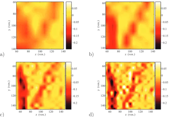 Fig. 8. Comparison between the ε zz -component of the strain ﬁeld in the x = 100 vox- vox-els plane, determined using diﬀerent ZOI sizes a) 16; b) 12; c) 8; d) 6 voxvox-els