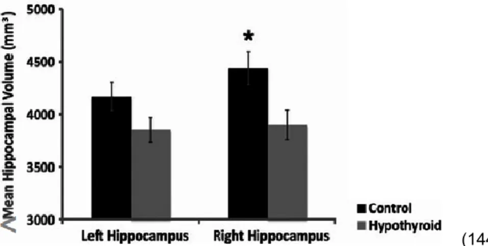 Figure 14 : Diminution du volume hippocampique chez des patients en hypothyroïdie. 
