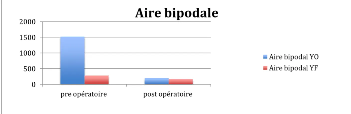 Figure 32 cas 1 0 5 10 15 20  Force pousser 