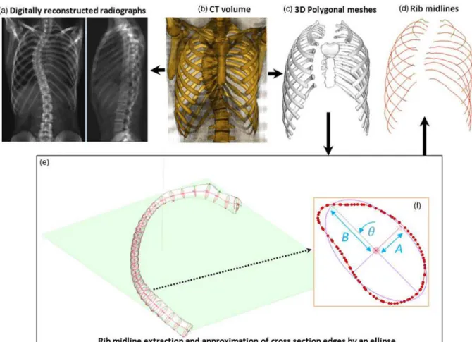 Figure 2: Data extraction from CT scans: The CT volumetric dataset (b) was used to  compute two digital reconstructed radiographs (a) and to perform the 3D reconstruction (c)