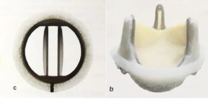 Figure 5. Photographies d’un modèle de prothèse mécanique à double ailettes SJM® [5] à gauche et  d’un modèle de bioprothèse Carpentier-Edwards Perimount® [5] à droite