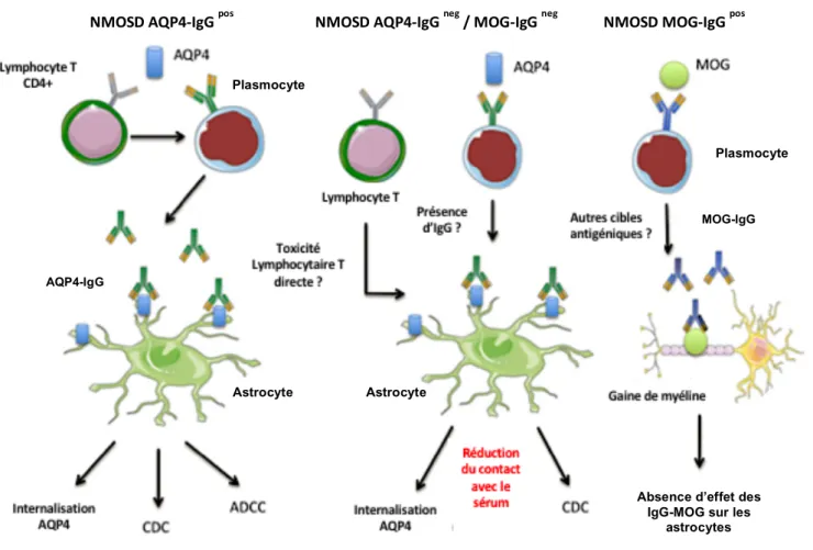 Figure 5 Représentation schématique des voies de la pathogénicité des NMOSD séropositives pour l’AQP4-IgG  (NMOSD AQP4-IgG  pos ), doubles séronégatives (NMOSD AQP4-IgG  neg  / MOG-IgG  neg ) et séropositives pour  la MOG-IgG (NMOSD MOG-IgG  pos )