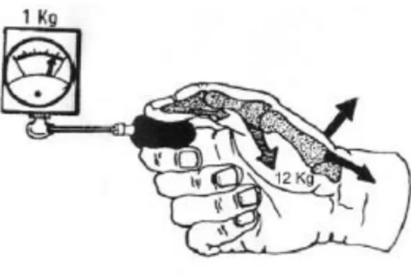 Illustration Cooney WP, Chao EY. Biomechanical analysis of static forces in the thumb during hand function