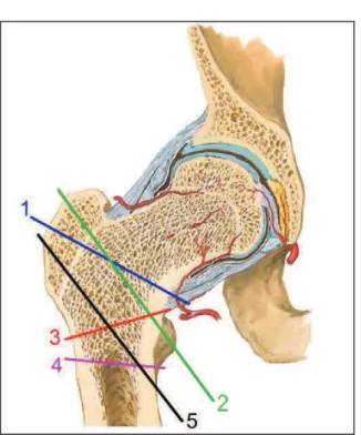 Figure 7 : Descriptif de la fracture selon son trait
