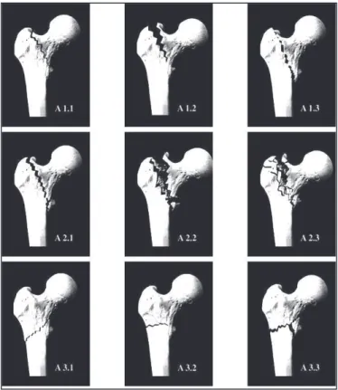 Figure 8 : Classification AO 