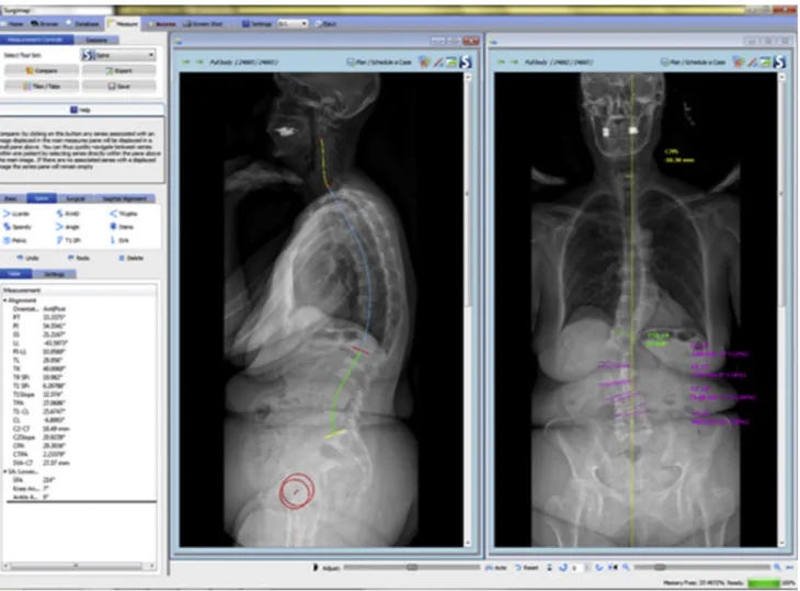 Fig. 2. Example of two-dimensional radiographic measurements.