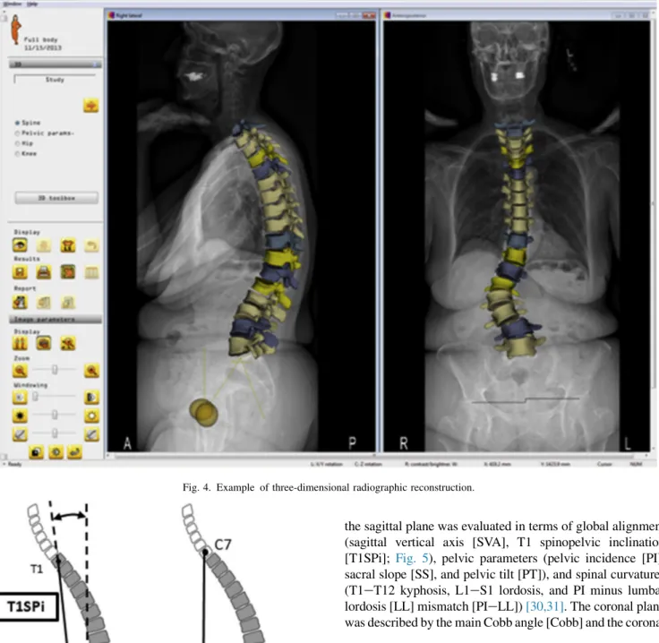 Fig. 4. Example of three-dimensional radiographic reconstruction.