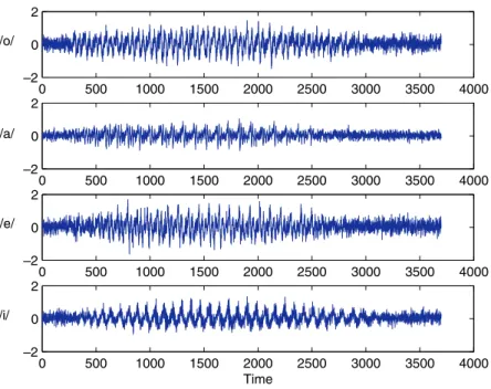 Fig. 4. Noisy versions of signals /o/, /a/, /e/ and /i/ (SNR in = 2 dB).