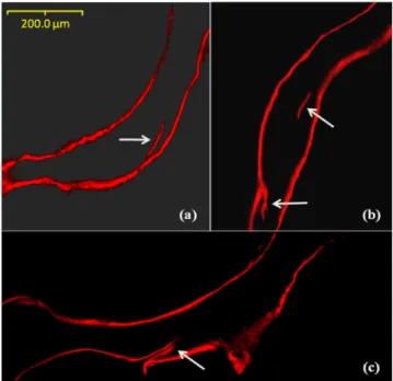 Fig. 7 Examples of damage observed in region 1 by confocal laser scanning microscopy: (a) and (b) two single linear microcracks; (c) split trabeculae
