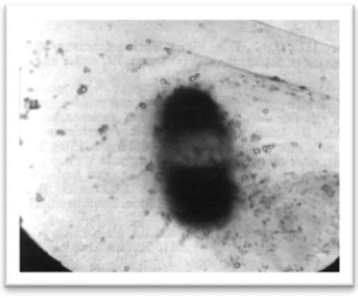 Figure   6   :   Observation   au   ME   x   14   000.   Bactériophages   autour   d’une   bactérie   vaguement    délimitée