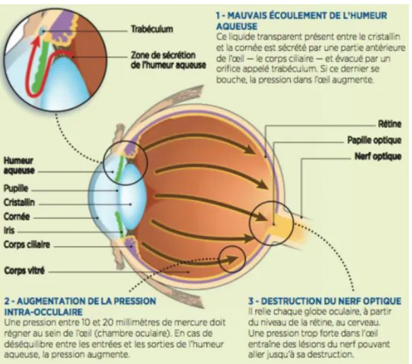 Figure 16 : Examen en tomographie de cohérence optique d’un glaucome à angle fermé  22