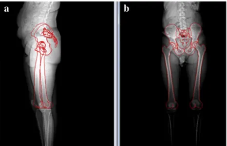 Fig. 1. Simultaneous bilateral whole-body low dose EOS® radiographs in standing position with morphological landmarks: (a) lateral view, (b) anteroposterior view.