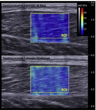 Fig. 1. Shear modulus assessment using elastography in rested and stretched gastrocnemius lateralis muscle