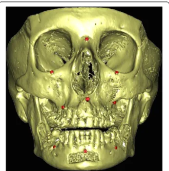 Fig. 1 Frontal 3D CT scan image view showing the nine cortical bone screws ( in red ) placed as references to define a  three-dimensional coordinate system (3 in the skull, 3 in the maxilla and 3 in the mandible)