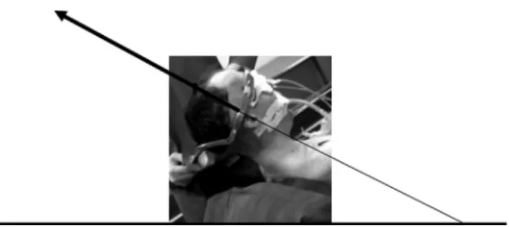 Fig. 2. AP and lateral radiographs of a patient non-operatively treated using a halo vest