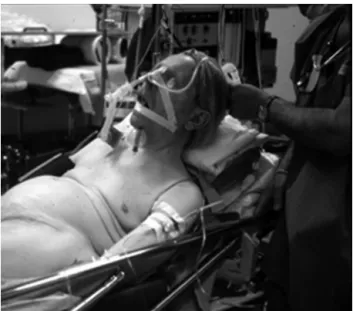Fig. 3. Kyphosis-related technical difﬁculties: endotracheal intubation, installation, and the surgical approach are demanding.