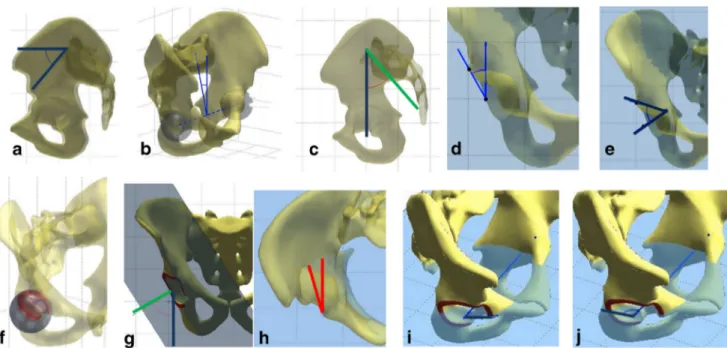 Fig. 3 Frontal and lateral digitally reconstructed radiographs of the pelvis at different increments of axial rotation positions with their corresponding 3D reconstructions