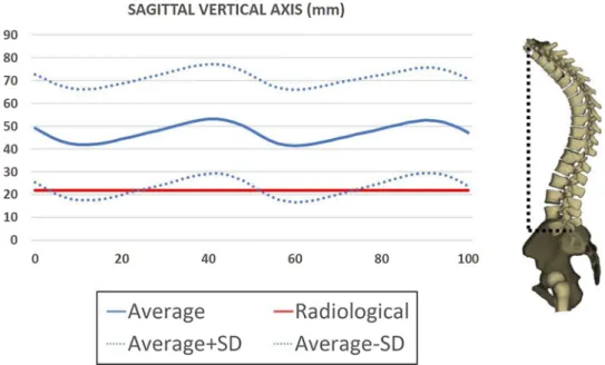 Fig. 2. Variation of the Sagittal Vertical Axis during walking in asymptomatic subjects in regards to its radiological value.