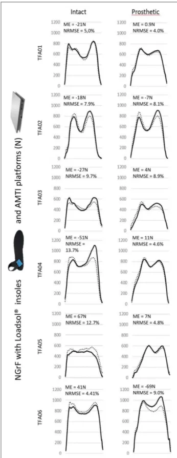 Figure 4 depicts ASI parameter results for each TFA  based on cadence. Concerning Fz1 asymmetry, five  jects had negative Fz1 ASI values at LSS and four  sub-jects, at SSS, corresponding to a higher Fz1 value for  the prosthetic limb than for the intact li