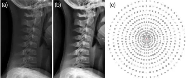 Fig.  1:  (a)  Original  image.  (b)  Enhanced  image.  (c)  Patches  arrangements around every candidate pixel