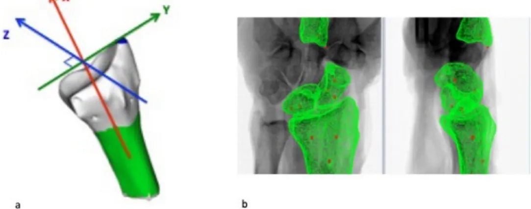 Fig. 1. a) Radius local frame: red axis  =  prono supination axis, green axis  =  Flexion Extension axis, blue axis  =  Radio Ulnar Deviation axis