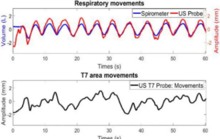 Figure 1a shows the respiratory volume (blue curve) obtained with the spirometer and the respiratory amplitude measured thanks to the two ultrasound probes (red curve)