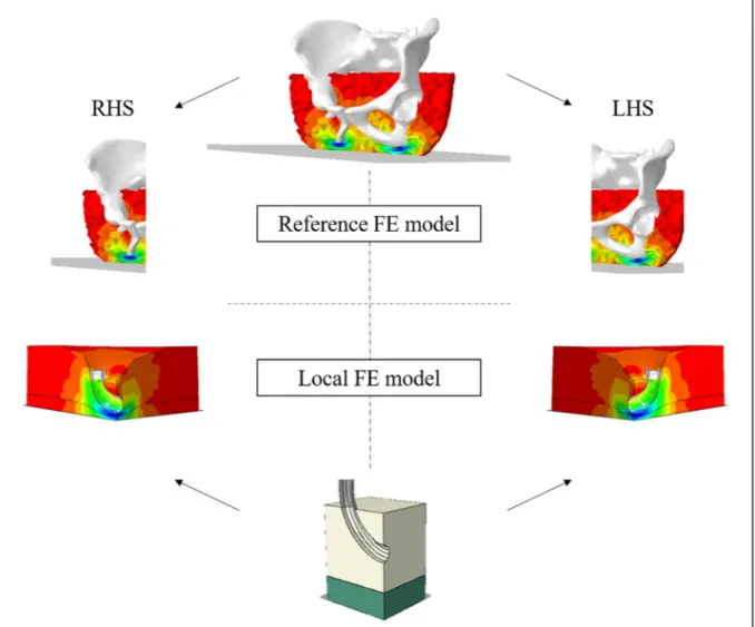 Fig. 1. Reference FE model (top) and associated LHS and RHS local FE models (bottom) for one subject.