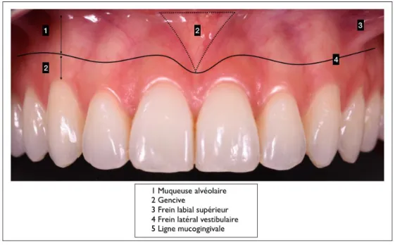 Figure 1 : Le complexe muco-gingival 