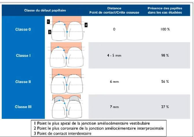 Tableau 2 : Classification des pertes papillaires de Nordland et Tarnow 