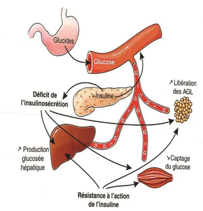 Figure 1 : Impact des anomalies de l’insulinosécrétion dans le diabète de type 2 (Shulman et  al, 2000) 