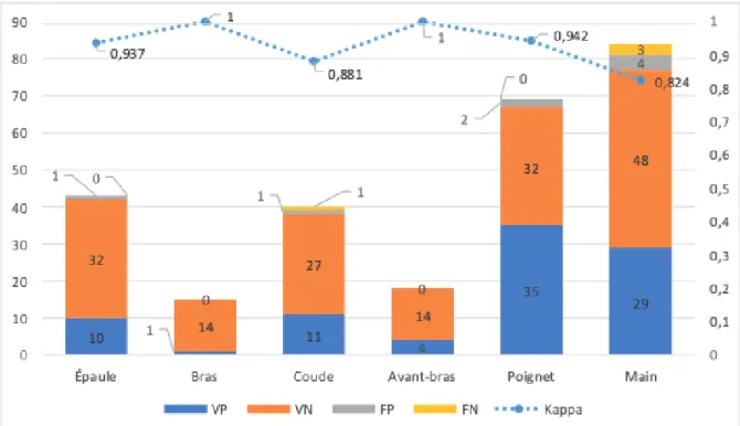 Tableau 11 : Concordance entre l'urgentiste et le radiologue en fonction de la localisation anatomique de la  radiographie 