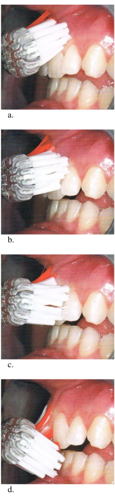 Fig. : 2.3. Chronologie du mouvement de la brosse à dents lors du brossage selon la méthode de Bass  (Muller-Bolla et al., 2013)