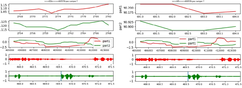 Figure 26 : Courbes multiparamétriques d’un moment saillant - Début de l’interaction lors  d’une interruption