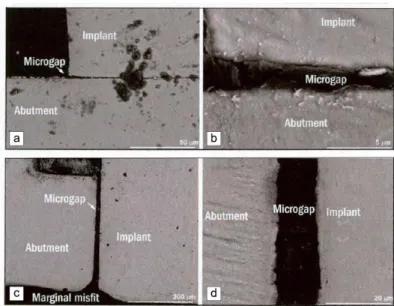 Figure 5 : Images de joints implant-pilier après tests d’usure (microscopie électronique à balayage) 