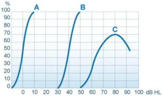 Figure 8 : Audiogramme vocal 