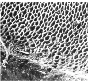 Figure 2: Structure en &#34;nid d'abeille&#34; de l'émail érodé. 