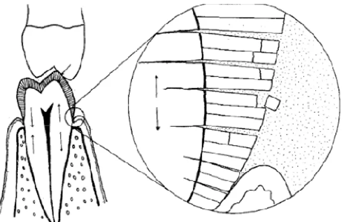 Figure 3: Schéma descriptif du phénomène d'abfraction. 