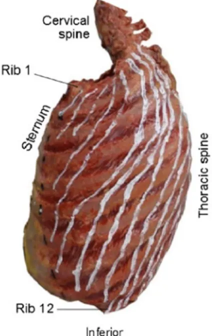 Figure 1. extracted rib cage with the lines that show the direction  of the iCm fibers.