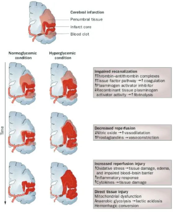 Figure 7 :  Hypothèses physiopathologiques du rôle délétère de  l’hyperglycémie d’admission  sur le pronostic fonctionnel après une ischémie cérébrale (6)