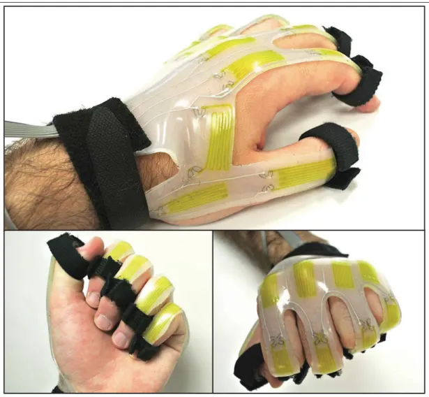 Figure 1.4 Wearable soft artiﬁcial sensing skin made of a hyperelastic elastomer material for detecting multi-joint motions.
